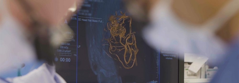 Imaging for a cerebrovascular surgery in the background of two surgeons operating